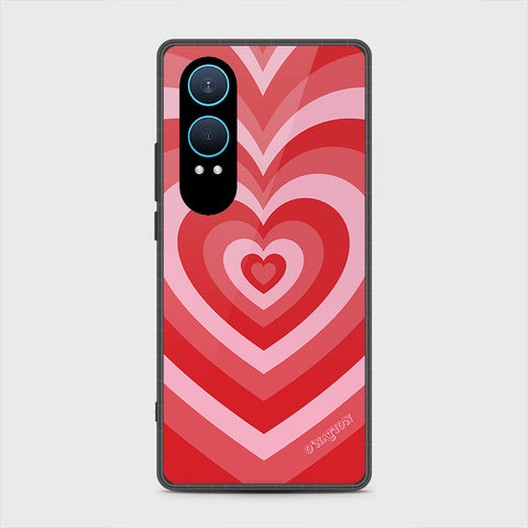 OnePlus Nord CE 4 Lite - O'Nation Heartbeat Series - HQ Premium Shine Durable Shatterproof Case