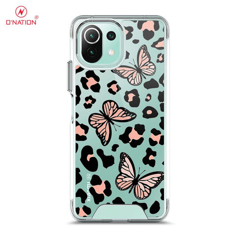 Xiaomi Mi 11 Lite Cover - O'Nation Butterfly Dreams Series - 9 Designs - Clear Phone Case - Soft Silicon Bordersx