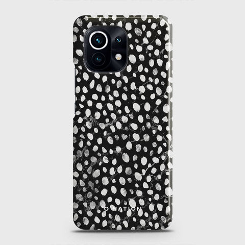 Xiaomi Mi 11 Lite Cover - Bold Dots Series - Matte Finish - Snap On Hard Case with LifeTime Colors Guarantee