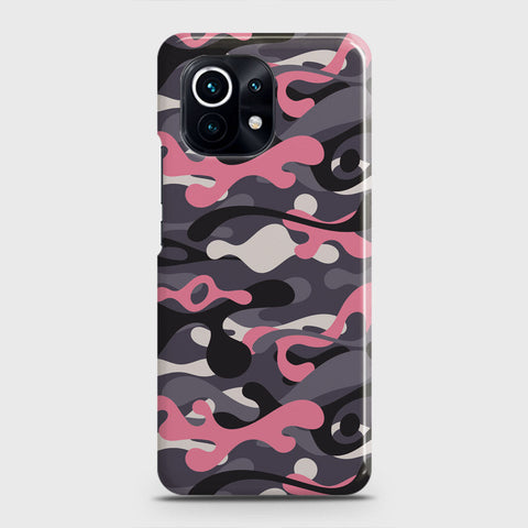 Xiaomi Mi 11 Lite Cover - Camo Series - Pink & Grey Design - Matte Finish - Snap On Hard Case with LifeTime Colors Guarantee